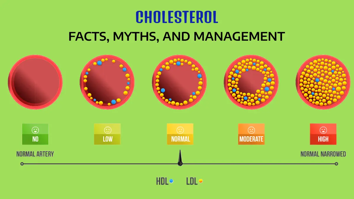 Cholesterol Facts, Myths, and Management
